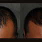 DeepRevive Hair Oil- Rosemary & Biotin